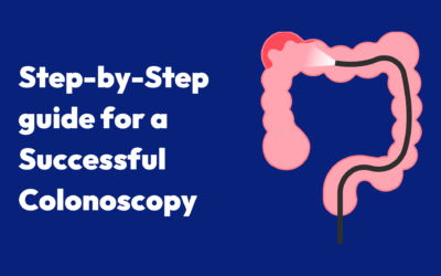 How to Prepare for a Successful Colonoscopy: A Step-by-Step Guide