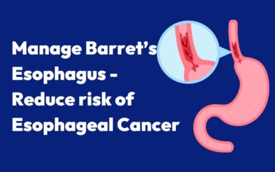 How to Manage Barrett’s Esophagus and Reduce Your Risk of Esophageal Cancer.